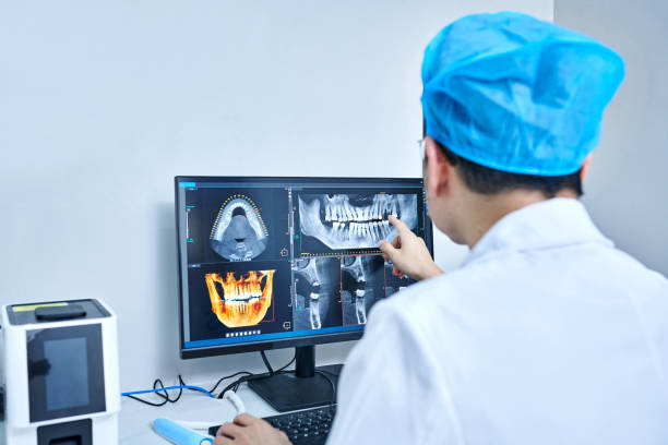 Best Emergency Tooth Extraction in Saticoy, CA